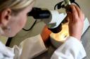 Blindness from some inherited eye diseases may be caused by gut bacteria, scientists have suggested (David Davies/PA)